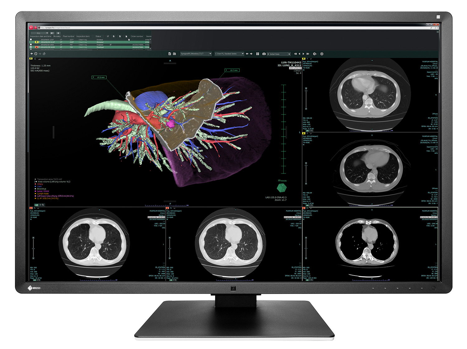 RadiForce RX660